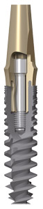 PerioType Rapid Zahnimplantat